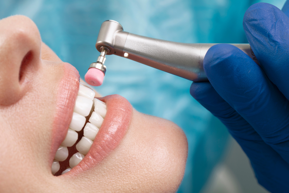 Khám răng định kỳ giúp giảm chảy máu nướu răng