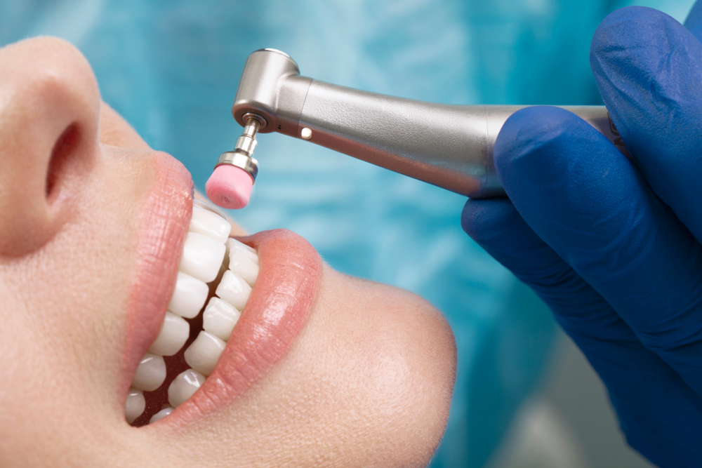 Khám răng định kỳ giúp giảm chảy máu nướu răng