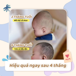 Gối định hình đầu chống méo, chống bẹp Unbee