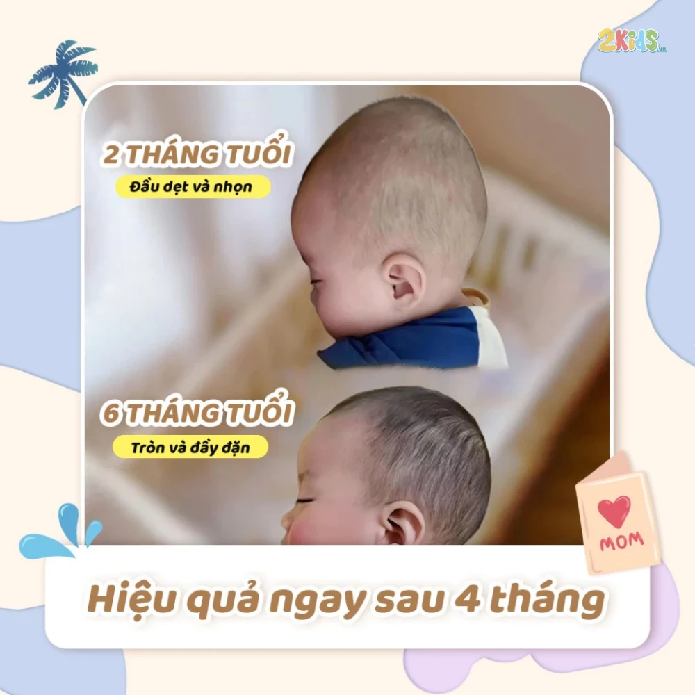 Gối định hình đầu chống méo, chống bẹp Unbee